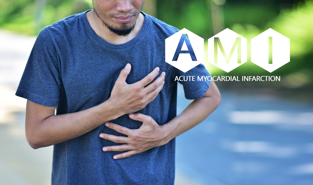 People are sick AMI Acute Myocardial Infarction,STEMI  ST Elevated Myocardial Infarction,PVC Premature Ventriular Contracture,CHF  Congestive Heart Failure
