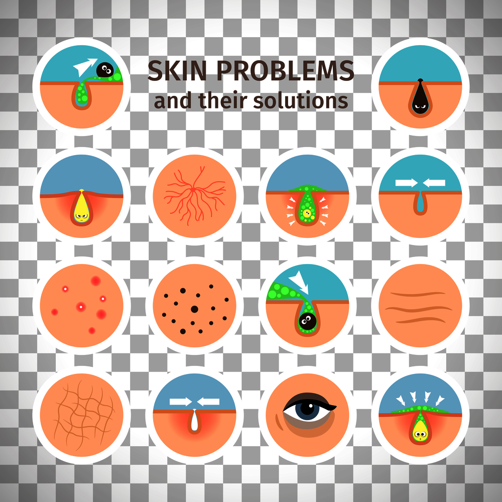 Skin problems. Facial treatments, face washing and problem correction isolated on transparent background vector illustration. Skin problem icons on transparent background
