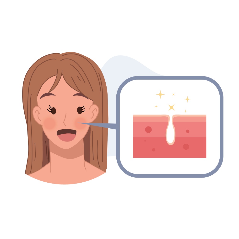 Acne treatment concept. Woman with no skin  problem ,no Pimles. a Clean and clear Face. Flat vector cartoon illustration.