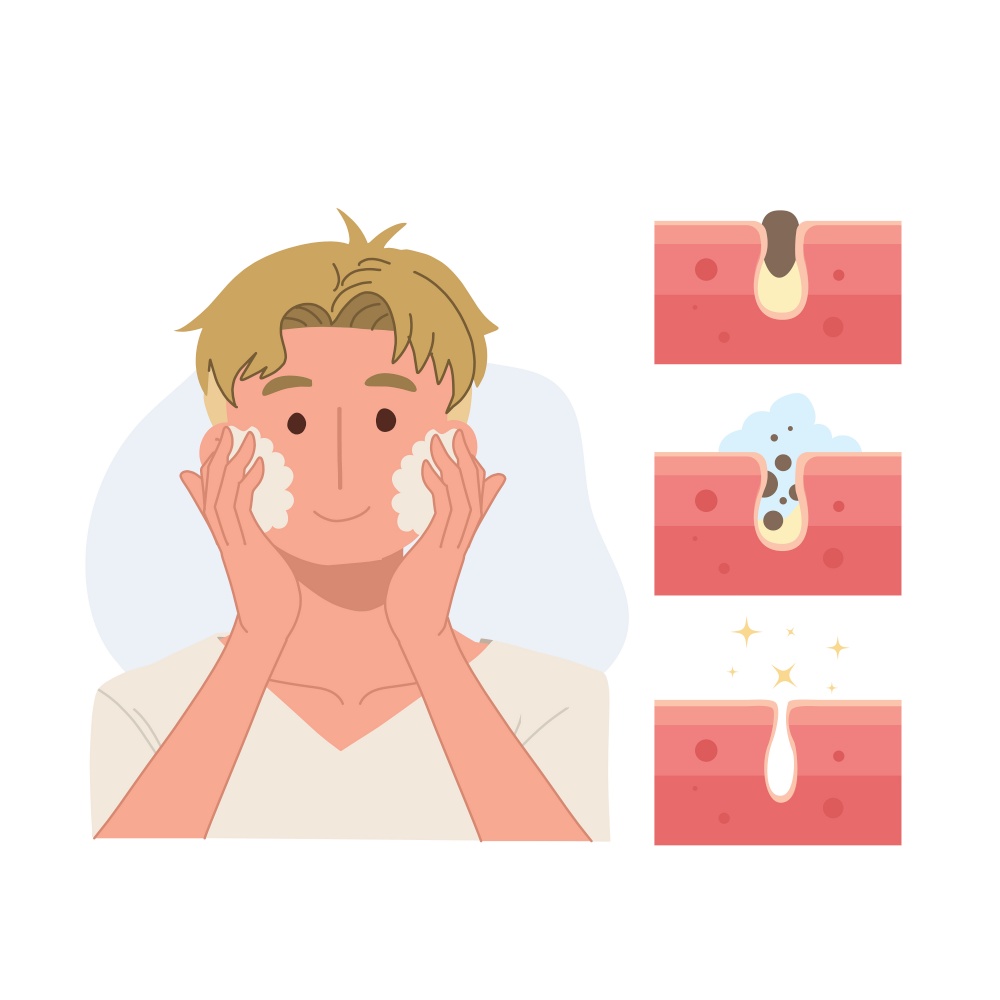Facial care, skin defects, skin problems, acne, facials. Face Care man concept. Step of remove acne. Vector illustration.