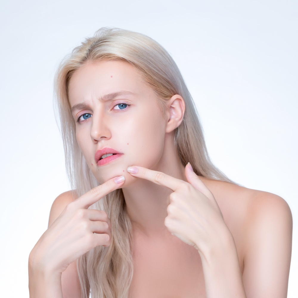 Acne problem troubling closeup personable worried woman with natural beauty skin checking her face squeezing pimple spots in isolated background. Copyspace for blemish skincare treatment problem.. Acne problem troubling personable worried woman with natural beauty skin closeup