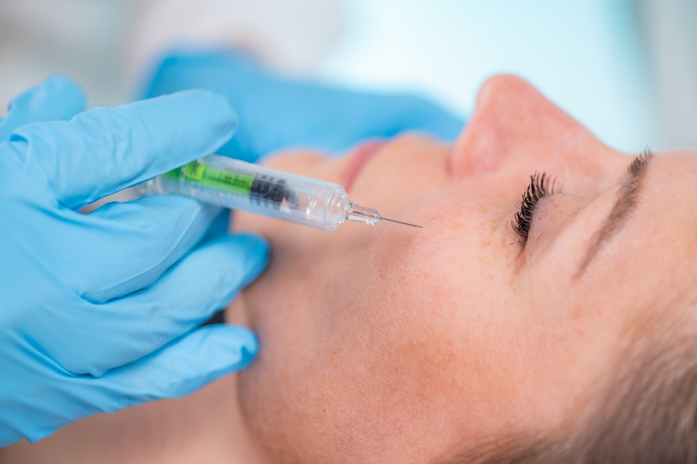 Hyaluronic acid treatment. Dermatologist plumping up cheeks with hyaluronic acid injection filler. Plumping up cheeks with hyaluronic acid treatment