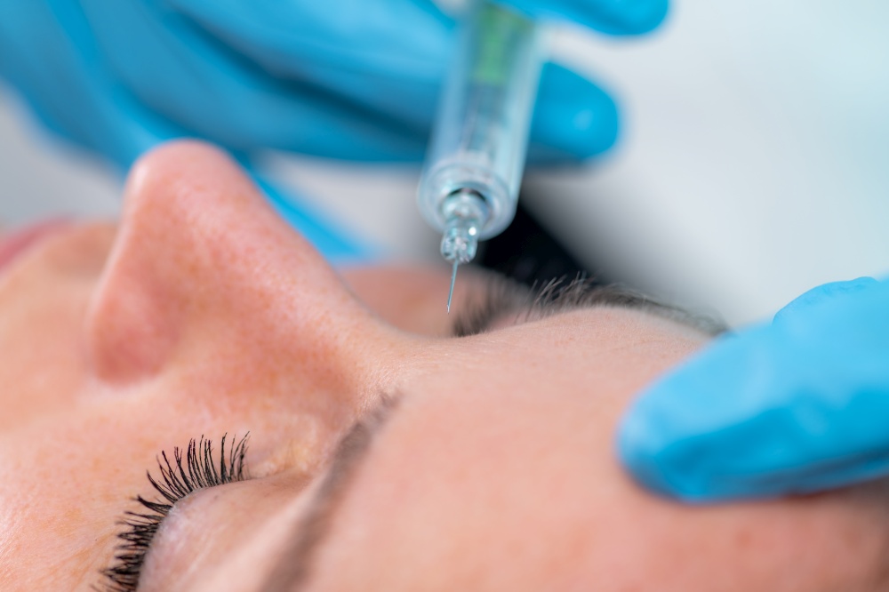 Treating forehead lines with hyaluronic acid filler, a dermatology treatment that targets forehead wrinkles using hyaluronic acid.. Treating Forehead Lines with Hyaluronic Acid Fillers