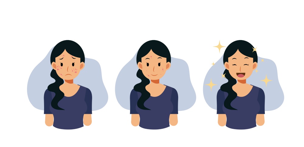 Acne concept.pimples. skin problems. step of Clear of acne.Flat vector cartoon character illustration.