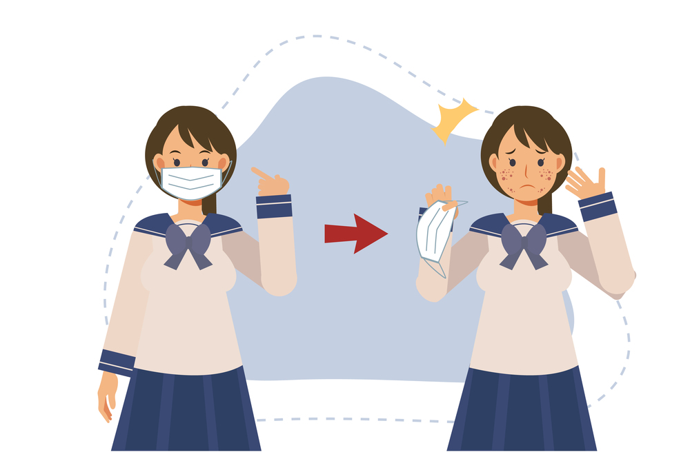 Acne caused wearing medical face mask.Maskne concept.pimples. skin problems. female japanese teenager student showing acne problem.Flat vector cartoon character illustration.