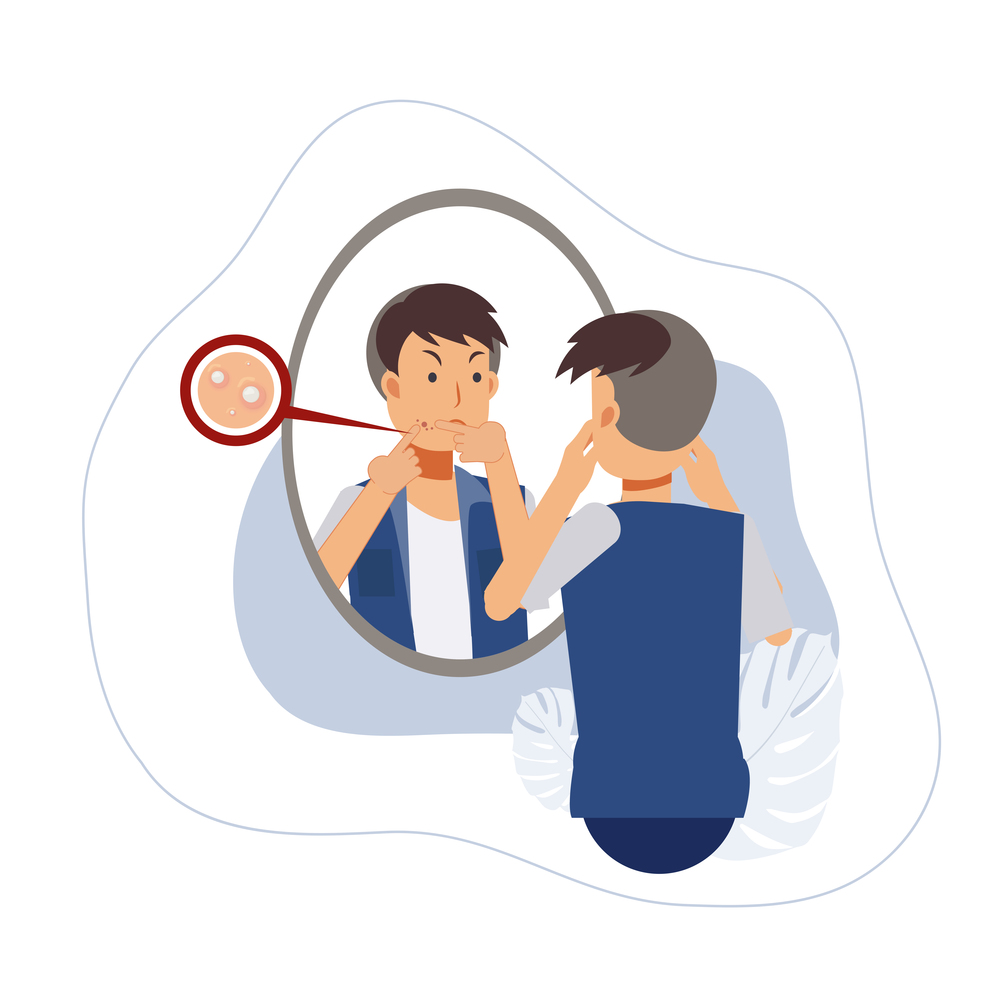 Acne treatment.A man squeezing his pimple, looks his reflection in the mirror and getting angry due to acne problem. Acne treatment. Flat Vector cartoon character illustration