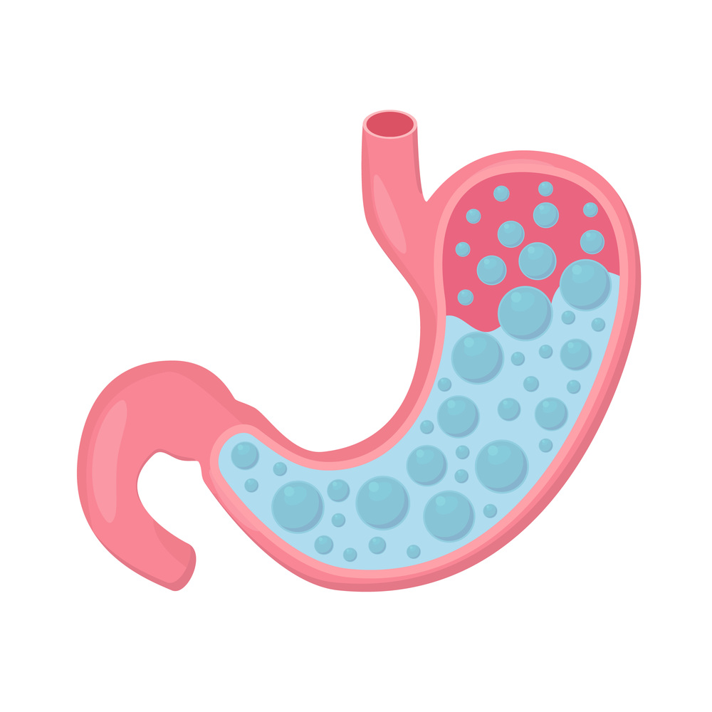 Stomach acid reflux. Healthcare Digestion. Disease, stomachache. Vector illustration in flat style. Stomach acid reflux.