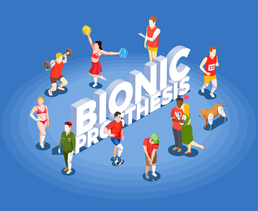 Bionic prosthetics isometric vector illustration with people involved in sports having artificial high tech legs and hands prosthesis. Bionic Prosthesis Isometric Vector Illustration
