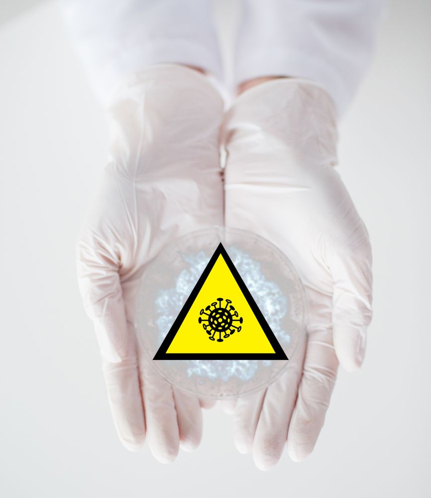 health, medicine and pandemic concept - hands in protective gloves holding petri dish with coronavirus test sample and caution sign. hands with coronavirus test and caution sign