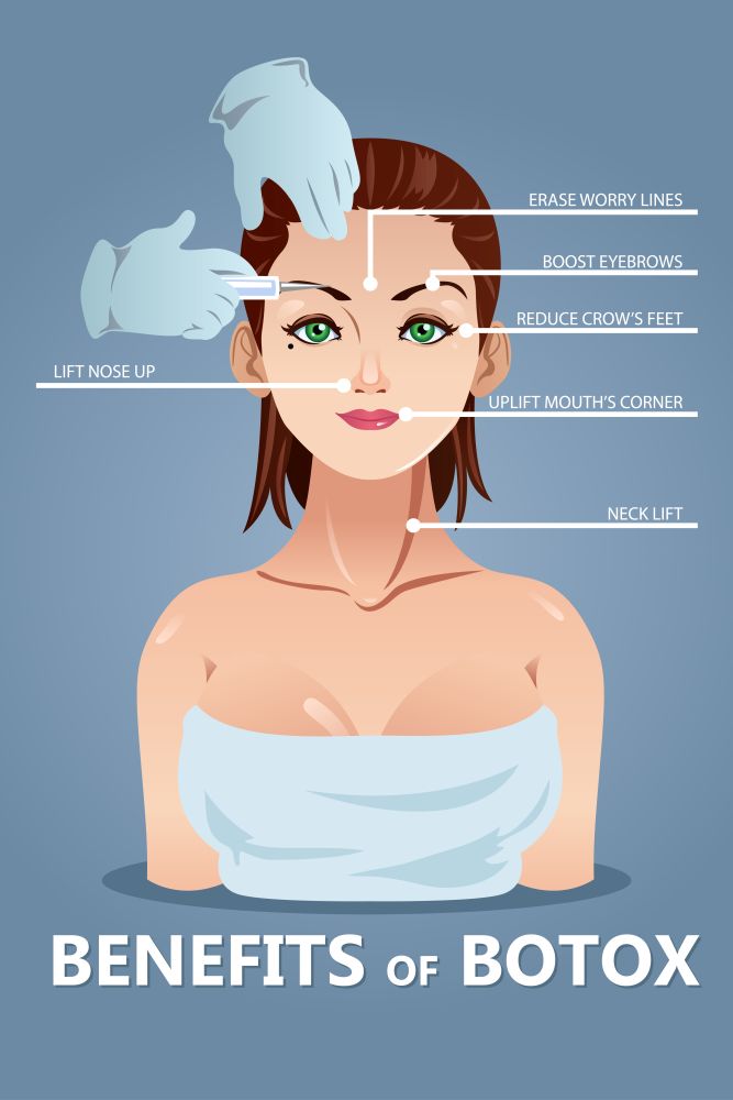 A vector illustration of benefits for botox infographic