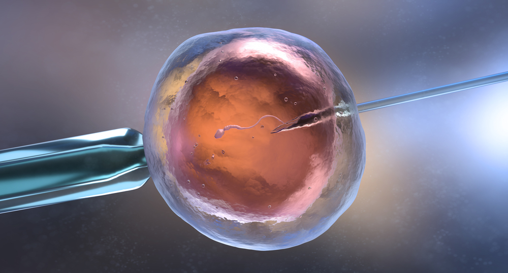 Artificial insemination or in vitro fertilization. 3D illustration. Artificial insemination or in vitro fertilization