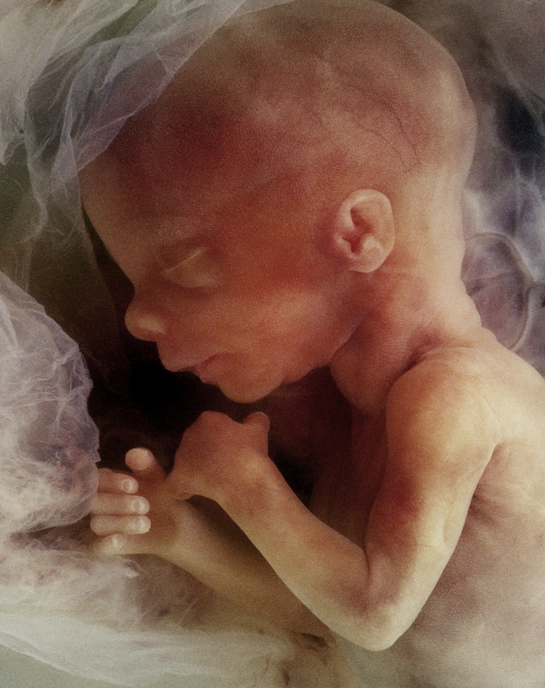 In-vitro image of a human fetus in the womb prior to birth - approx 12 weeks. after conception