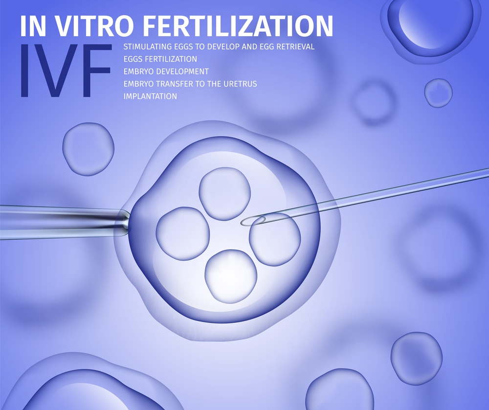 In Vitro Fertilization of Human Female Cell on Blue background. Laboratory Microscopic Research Macro Close Up View. Reproductive IVF Process Vector Realistic Illustration. Medical Banner, Copy Space.. In Vitro Fertilization of Human Female Cell Macro
