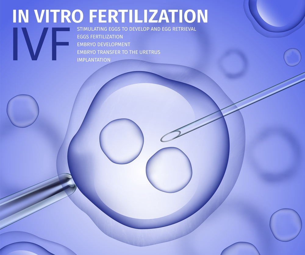 Professional In Vitro Fertilisation Process. Womans Egg Fertilised in Lab. Microscopic Research, Ovum with Needle. Reproductive System, IVF. Vector Realistic Illustration. Medical Banner, Copy Space.. Professional In Vitro Fertilisation Process Banner