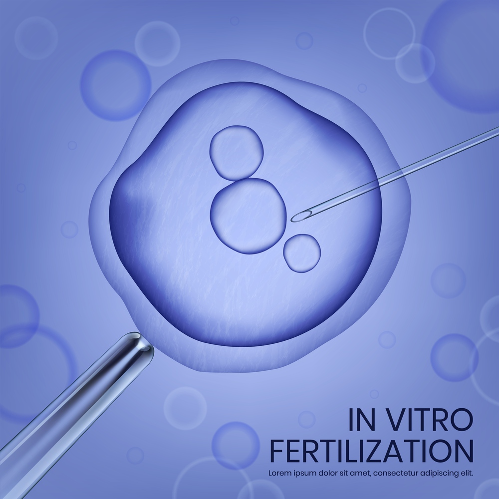 Microscope View of In Vitro Fertilization Process of Female Egg. Cell is Holding by Pipet and Neeldle with Clipping Path on Blue Background. Vector Realistic Illustration. Medical Banner, Copy Space. Microscope View of In Vitro Fertilization Process