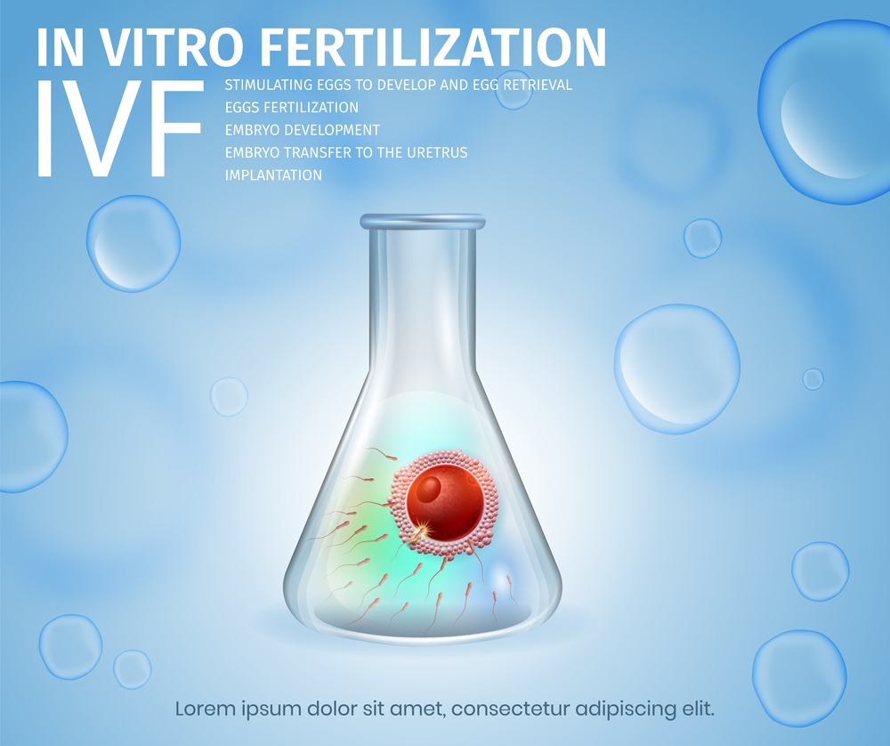 In Vitro Fertilization Process. Female Egg and Sperm Union Inside of Glass Beaker. Spermatozoons and Woman Cell in Test Tube. Reproductive System Technology. IVF. Vector Realistic Illustration. Banner. Female Egg and Sperm Union Inside of Glass Beaker.