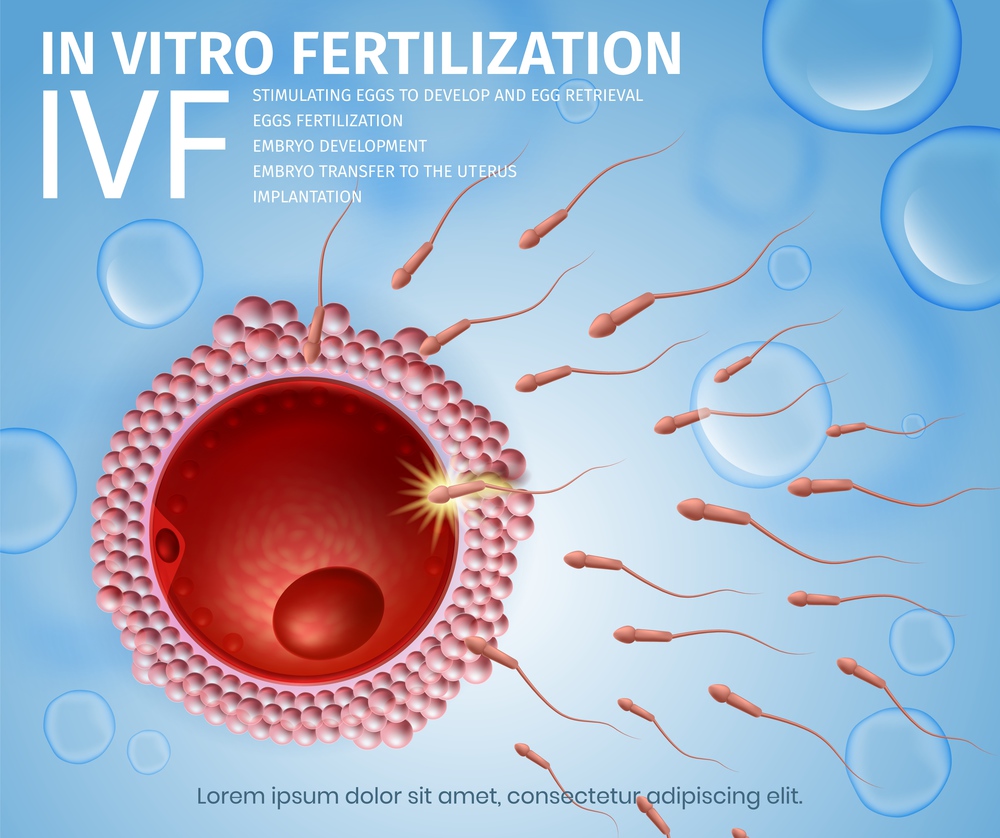 In Vitro Fertilization. Spermatozoons Cells Flowing Toward Female Egg. IVF Reproductive Process. Highly Detailed Scientific and Medical 3d Realistic Vector Illustration. Medical Banner, Copy Space.