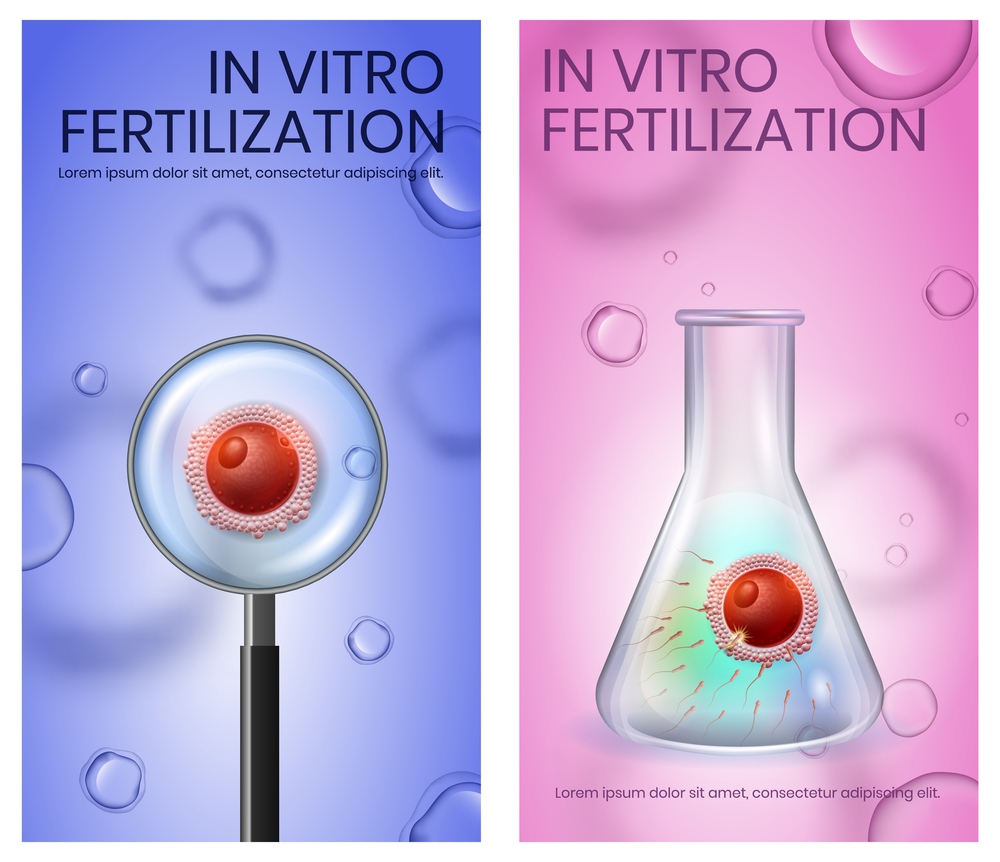 In Vitro Fertilization Vertical Banner Set. IVF. Female Egg Fecundation inside of Test Tube. Magnifier Macro View on Spermatozoons Attack Woman Cell. Vector Realistic Illustration. Poster, Copy Space. Female Egg Fecundation inside of Test Tube. IVF