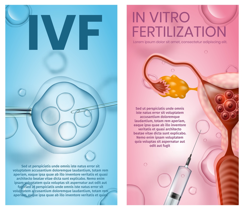In Vitro Fertilization Vertical Banner Set. IVF. Female Eggs Fertilised in Laboratory and Surgically Implanted Into Woman Womb Microscopic Research. Vector Realistic Illustration. Banner, Copy Space