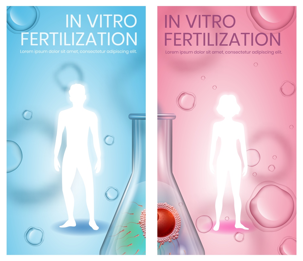 In Vitro Fertilization Vertical Banner Set, Copy Space. Abstract Faceless Male and Female White Silhouettes. Fertilized Egg in Beaker. Blue and Pink Background. Medical Vector Realistic Illustration. In Vitro Fertilization. Male and Female Silhouette