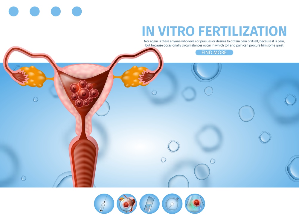 In Vitro Fertilization Medical Informational Banner. Anterior View of Female Uterus with Transfered Implanted Embryos. Reproductive Human System, IVF Icons, Vector Realistic Illustration, Copy Space.. In Vitro Fertilization Informational Aid Banner.