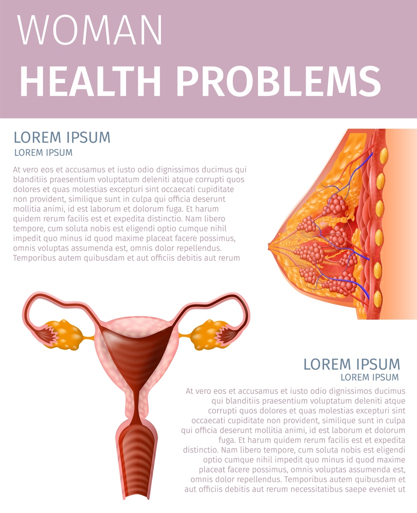 Woman Health Problem. Female Uterus and Breast Highly Detailed View Scheme. Aid of Woman Reproductive System Disorder. Anatomical Vertical Medical Banner with Copy Space. Vector Realistic Illustration. Woman Health Problem. Female Uterus and Breast