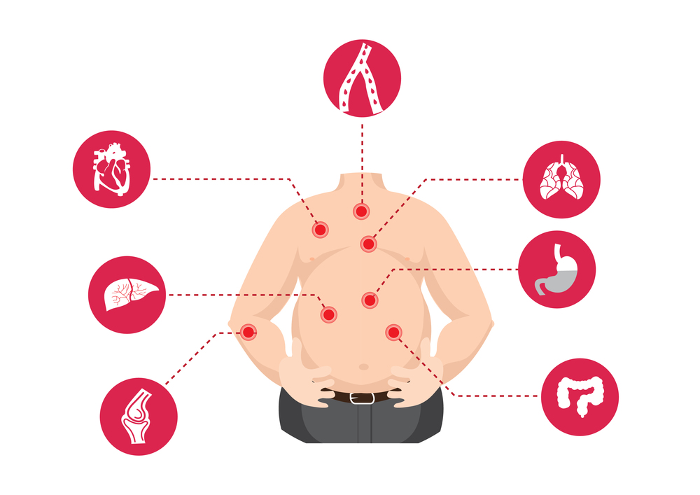 human fat with disease. Illustration in Infographic style about medical and health
