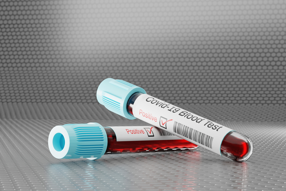 COVID-19 test detection. Test tubes in a test chamber containing a blood sample. 3D illustration.